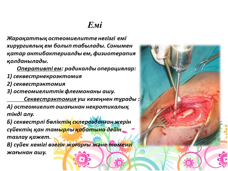 Жарақаттық остеомиелитте негізгі емі хирургиялық ем болып табылады. Сонымен қатар антибактериалды ем, физиотерапия қолданылады.